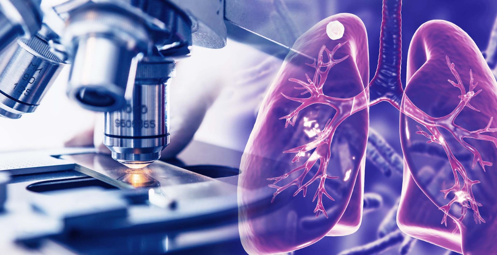 Capa Tuberculose