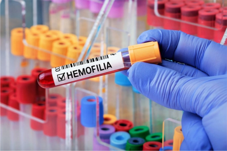 Capa texto Hemofilia-1