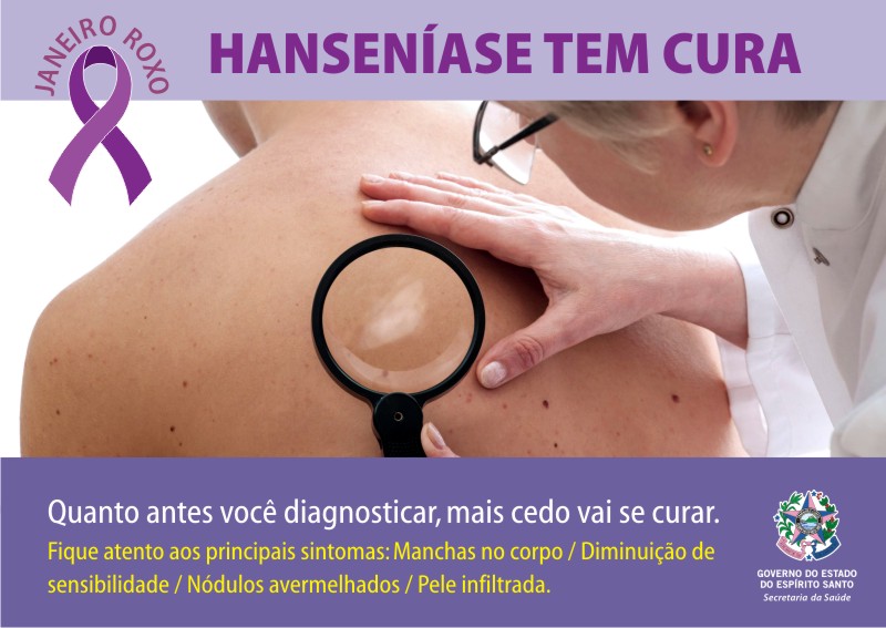 Janeiro Roxo