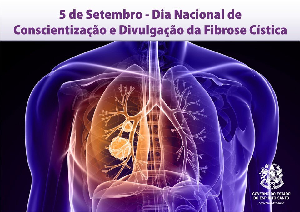 Setembro Roxo: A importância da conscientização sobre a fibrose cística